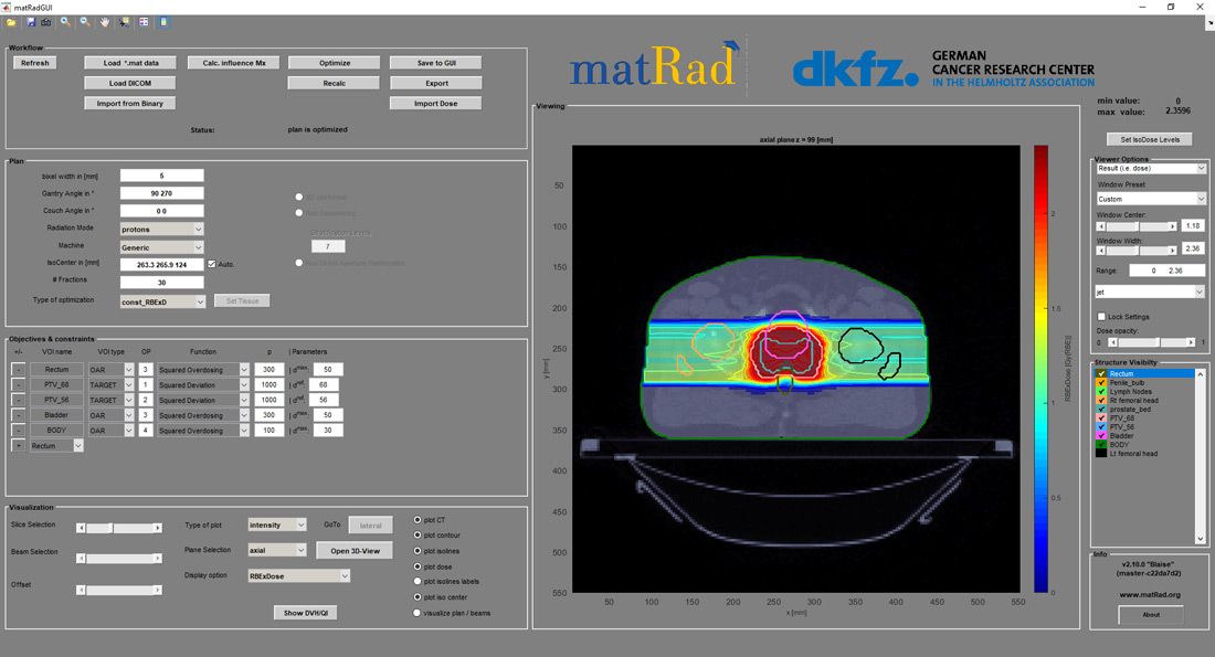 图 1.matRad 2.10.0 界面，包括工作流、计划、优化和可视化控件。该界面显示使用两个相反射束角度和扫描质子的前列腺治疗计划