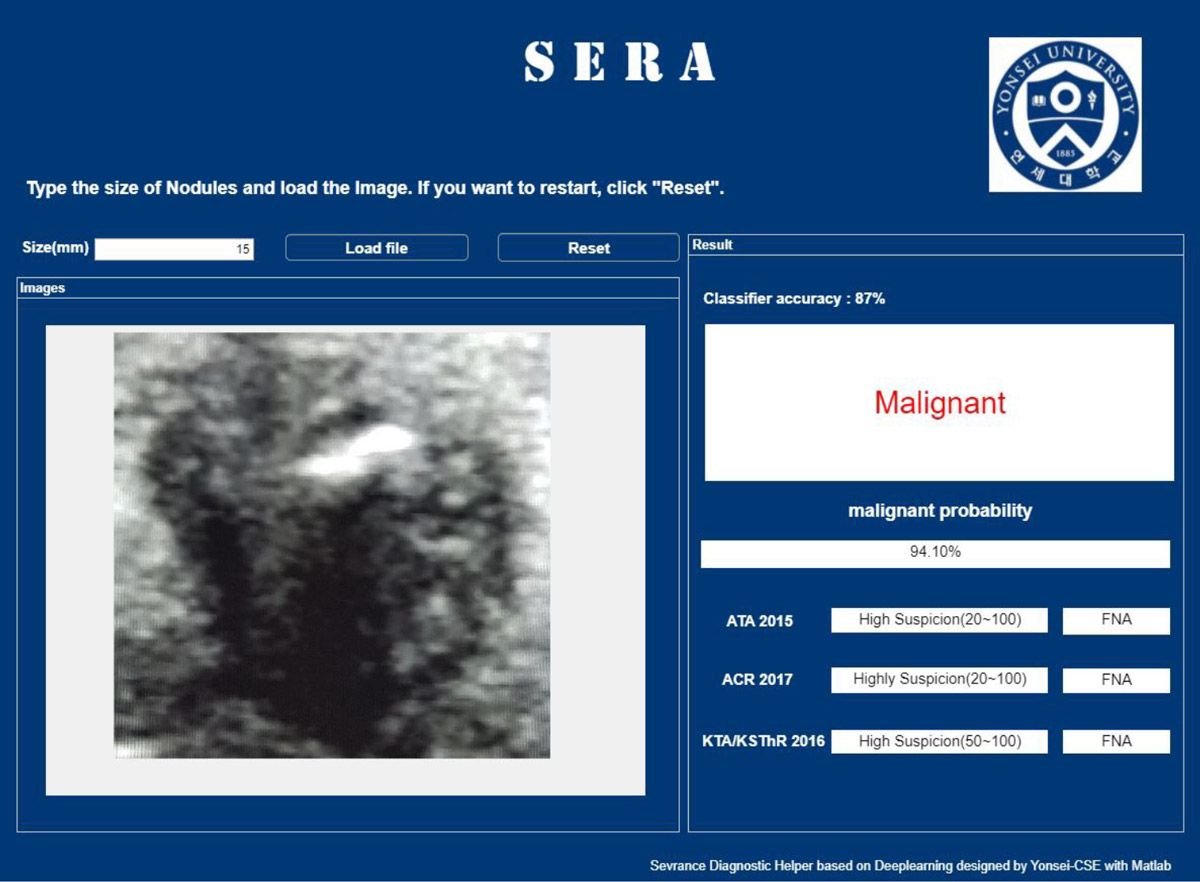 SERA Web App 的截图，显示基于结节图像的诊断结果，并以 94.10% 的概率将其归为恶性类别。分类器准确度为 87%。