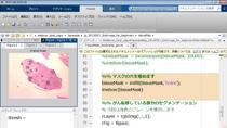 バイオ・メディカルの分野では、必ずしも鮮明でない細胞などのデジタル画像から特徴を抽出し、数値化する解析などが多く要求されます。MATLABに備わっている豊富な画像処理ライブラリを組み合わせることにより、高度なバイオイメージング・医用画像処理をシンプルに実現することができます。