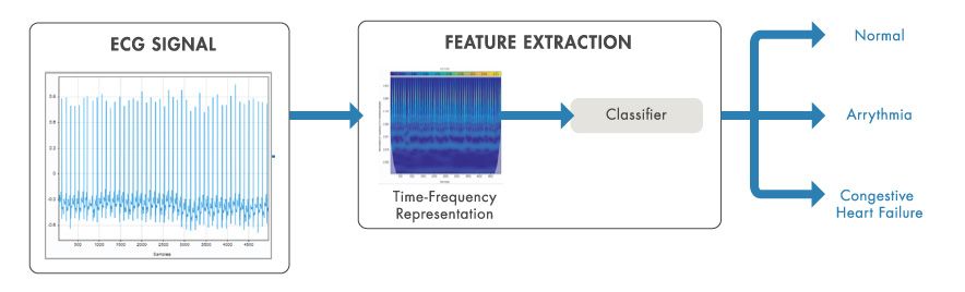 时频分析用于从 ECG 信号中提取特征以进行分类。