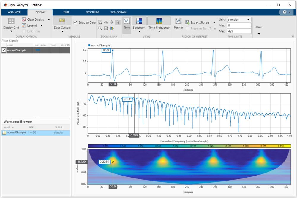使用 MATLAB 中的信号分析器在时域、频域和时频域中分析 ECG 信号。