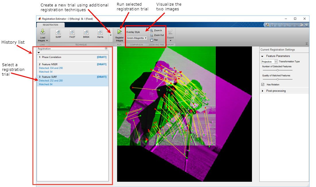 Interactively comparing feature-based, intensity-based, and nonrigid registration techniques using the Registration Estimator app.