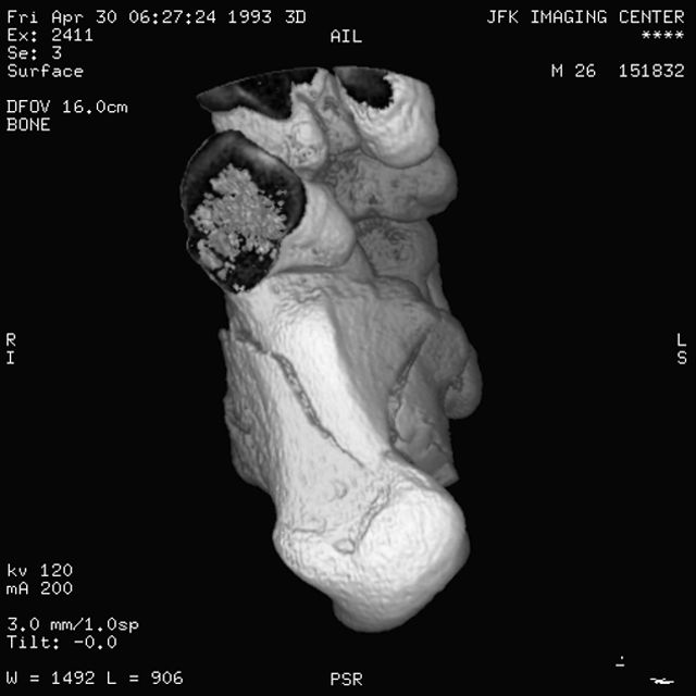 DICOM 文件，可以在 MATLAB 中对其进行读取、写入和匿名化。