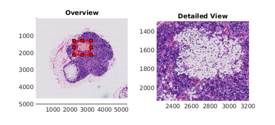 使用 MATLAB 中的 <code>bigimageshow</code> 显示的包含肿瘤组织的淋巴结图像。