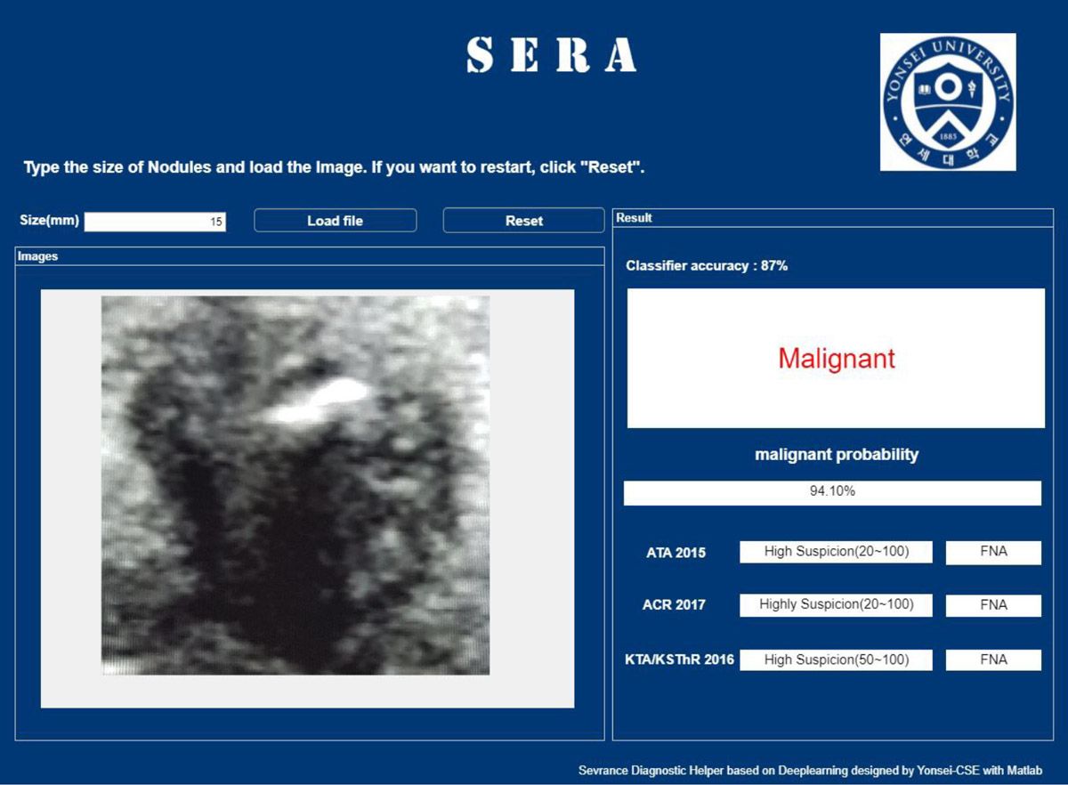 A screenshot of the SERA web app presenting results on an image of a nodule and categorizing it as malignant with a probability of 94.10%. Classifier accuracy is 87%.