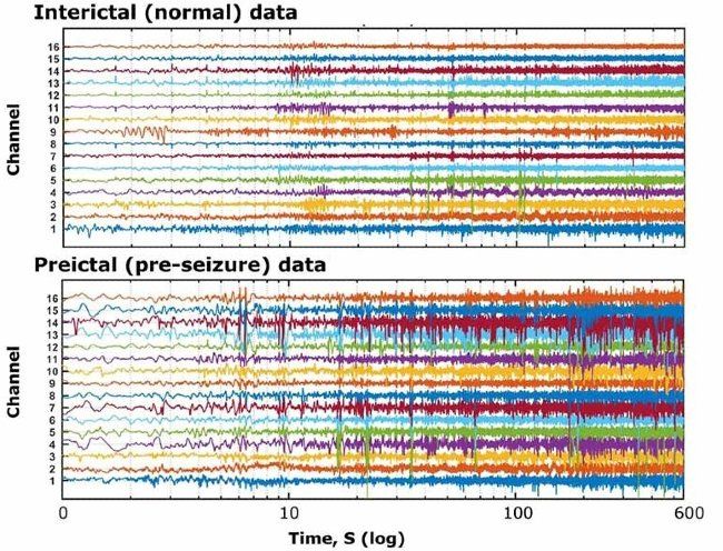 Figure 1. Intracranial EEG data provided by Kaggle.