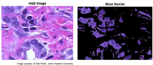 Side-by-side images of original stained tissue and segmented image with cell nuclei highlighted in blue.
