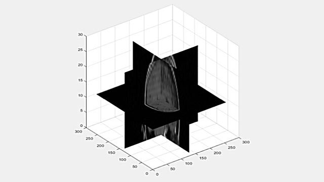 Viewing a 3D volume as 2D slices.