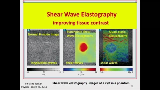 This plenary talk describes recent innovations in medical ultrasound and ultrasound research, simulations, and research systems using MATLAB.