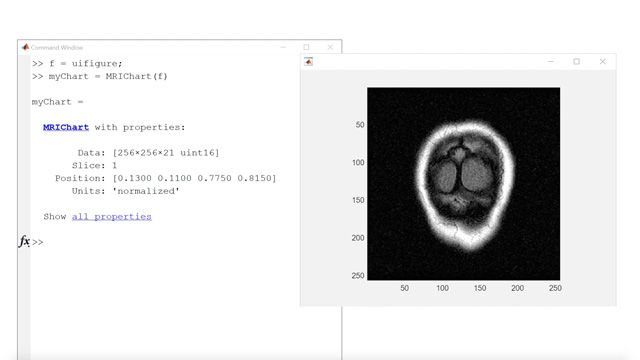 Learn how to build specialized data visualizations and components and how they help modularize MATLAB apps.