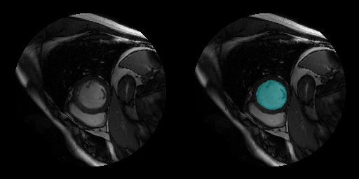 MRI image of the heart and ground truth segmentation mask of the left ventricle