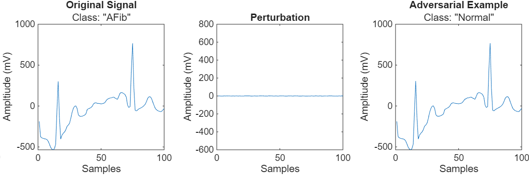 Three plots comparing an original AFib signal, a small perturbation, and an adversarial example classified as Normal. The adversarial example looks very similar to the original signal.