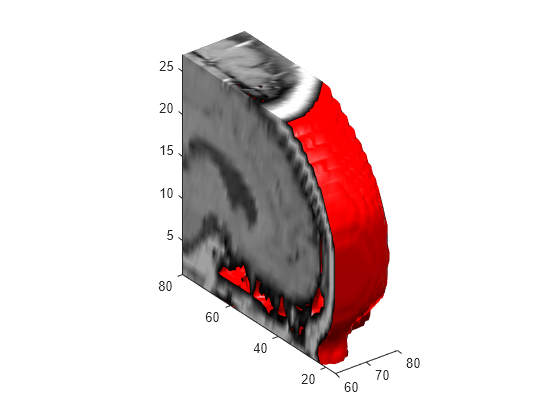 Figure contains an axes object. The axes object contains 2 objects of type patch.