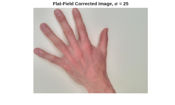 Figure contains an axes object. The hidden axes object with title Flat-Field Corrected Image, sigma = 25 contains an object of type image.