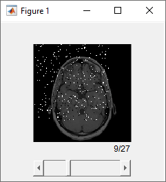 Slice of noisy volume displayed in Slice Viewer.