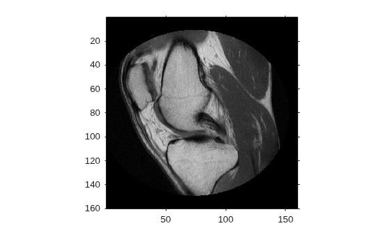 Figure contains an axes object. The axes object contains an object of type image.
