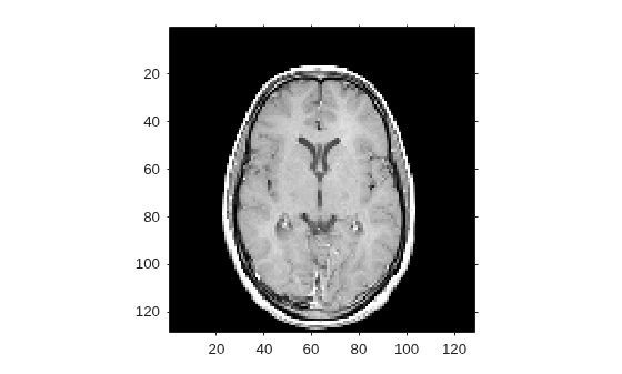 Figure contains an axes object. The axes object contains an object of type image.