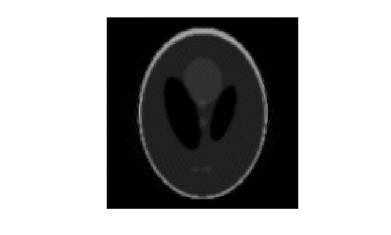 Figure contains an axes object. The hidden axes object contains an object of type image.
