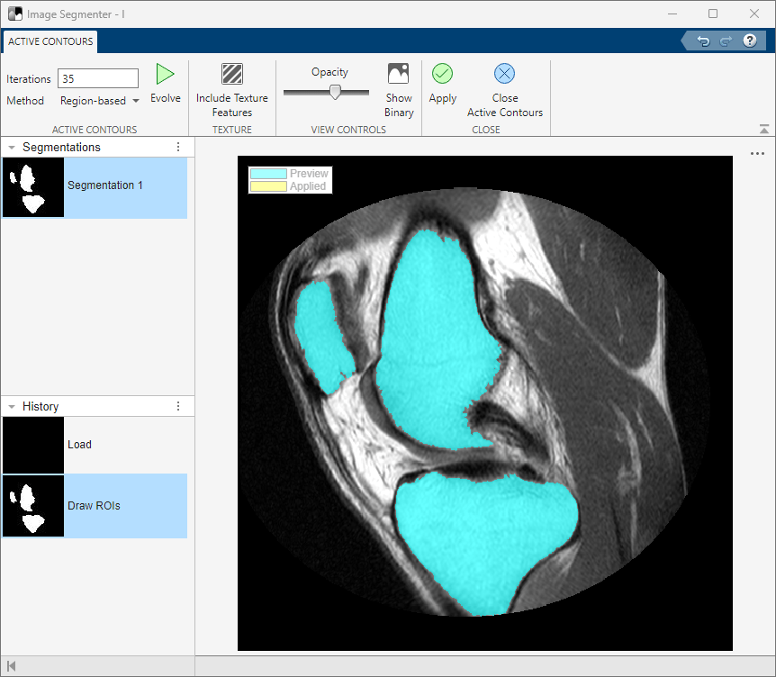 The Active Contours tab is open and the Iterations text field reads "35". The sections are defined more clearly without as much bleed into the background.