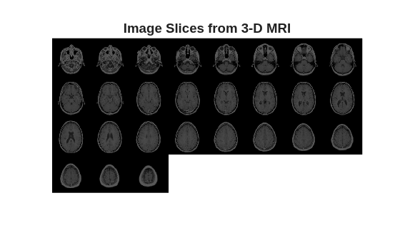 Figure contains an axes object. The hidden axes object with title Image Slices from 3-D MRI contains an object of type image.