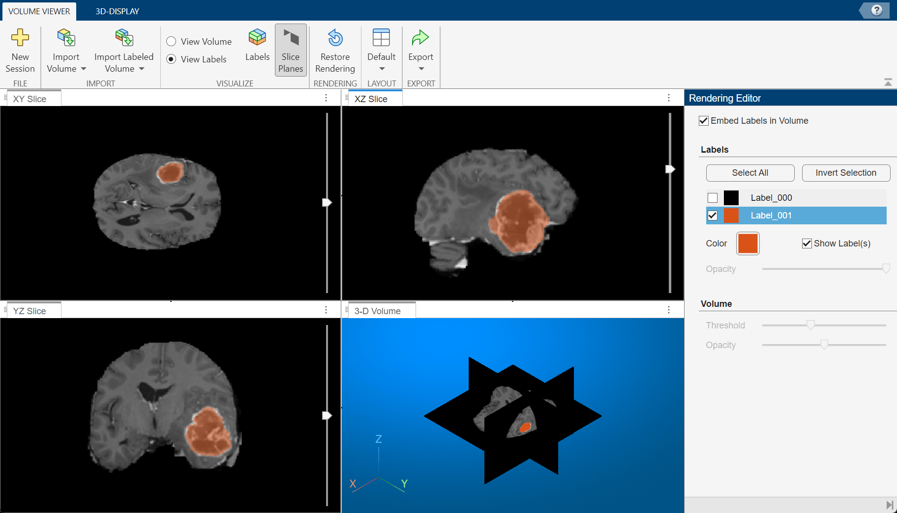 Create and Display 3-D Mask of DICOM-RT Contour Data