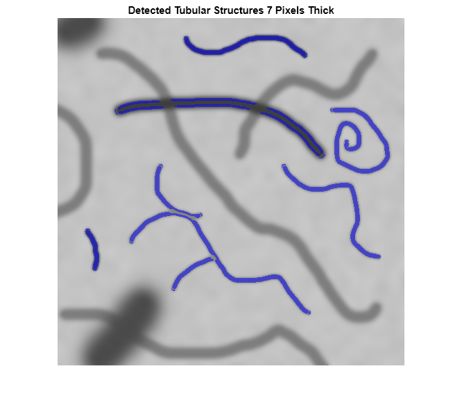 Figure contains an axes object. The hidden axes object with title Detected Tubular Structures 7 Pixels Thick contains an object of type image.