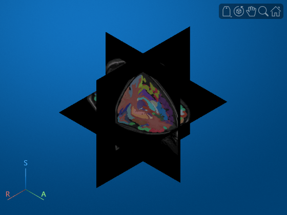Segment and Analyze Brain MRI Scan Using AI