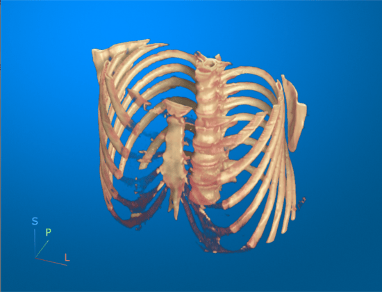 Display Medical Image Volume in Patient Coordinate System