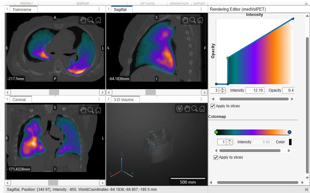 Explore Multimodal Medical Image Data Using Medical Volume Viewer