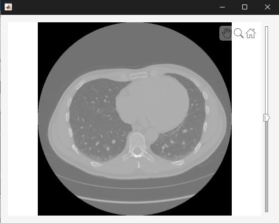 Create an App to Explore 3‑D and 4‑D Medical Volumes with Synchronized Multi‑Panel Views