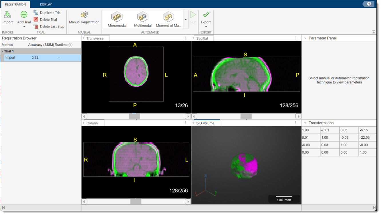 Medical Registration Estimator app window after importing the volumes with the initial transformation