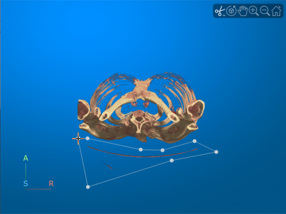 Viewer window showing drawn polygon around the bed region to remove