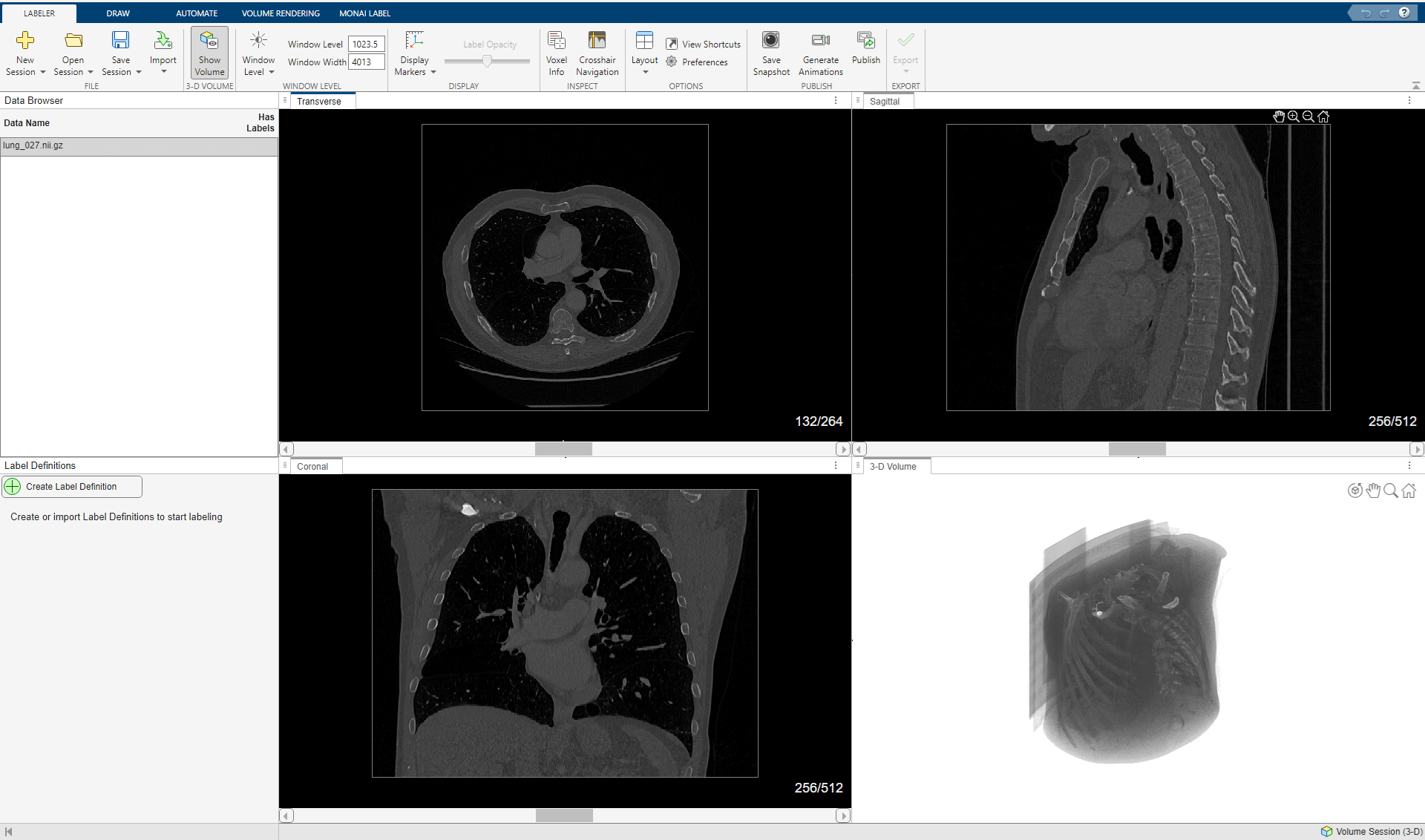Data loaded in Medical Image Labeler