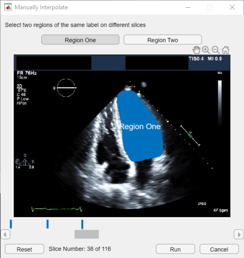 Manually Interpolate dialog box for selecting the label regions and slices for interpolation