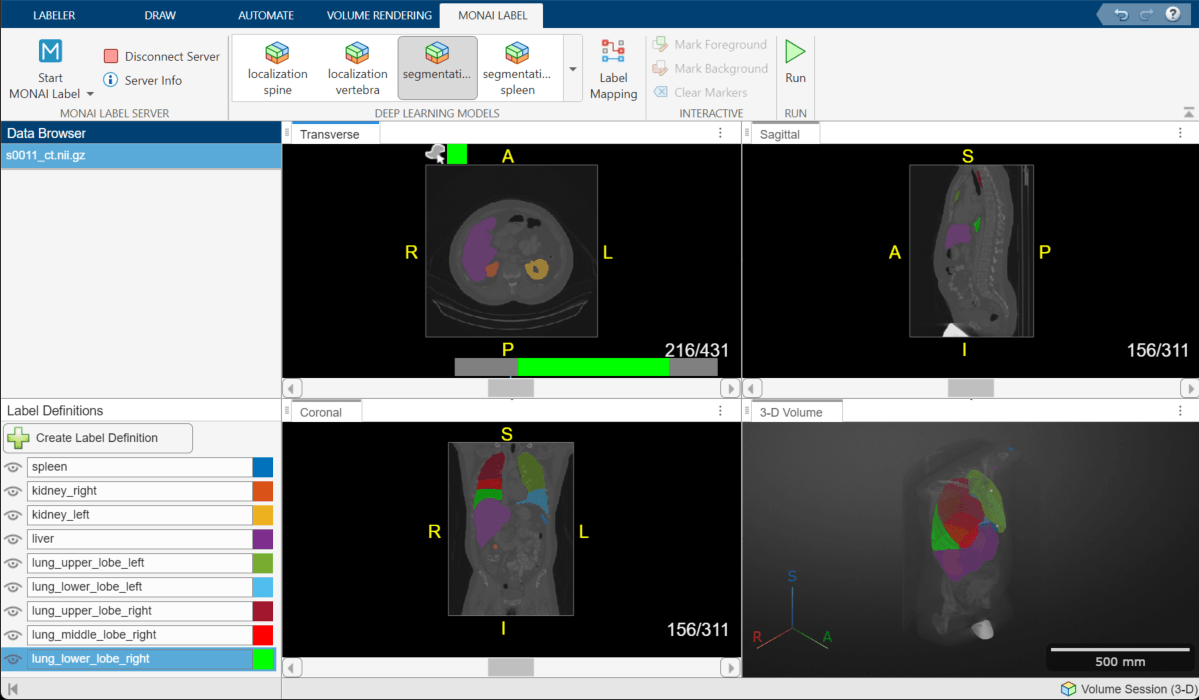 Medical Image Labeler app window showing the labels predicted by the segmentation model.