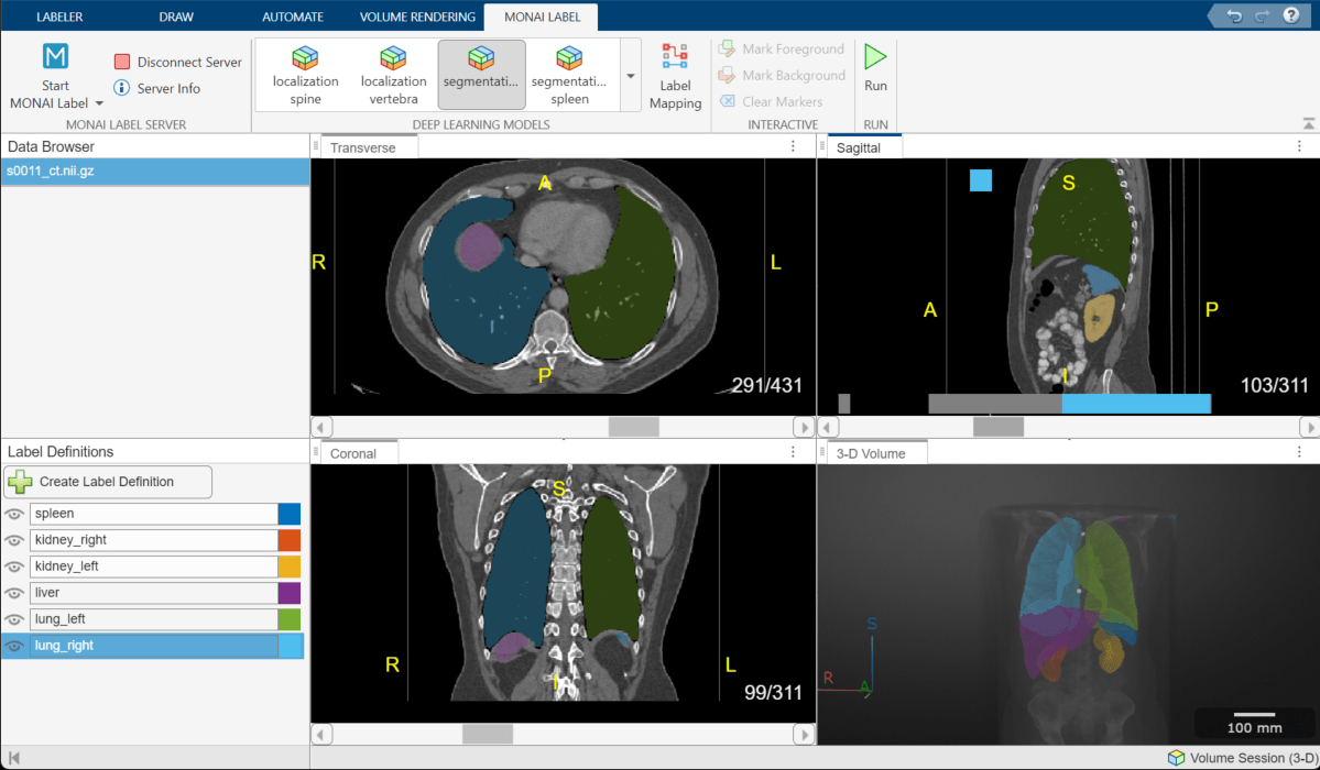 Medical Image Labeler window showing the updated segmentation model results after mapping the lung lobe models to a unified label definition for each full lung.