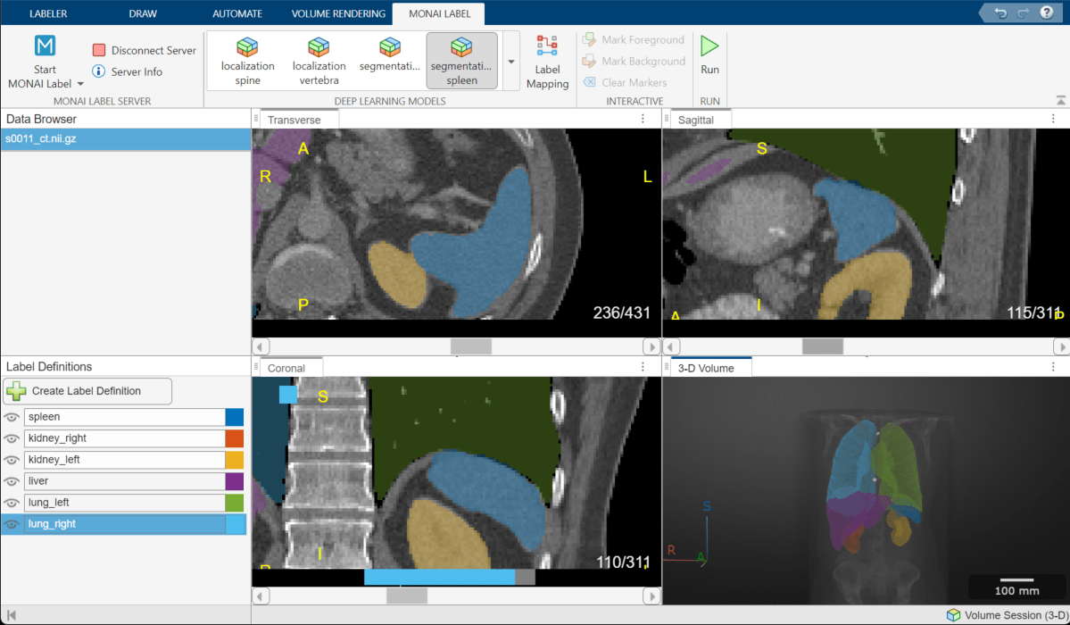 Label Mapping dialog box, showing mapping from the right kidney MONAI Label to the existing kidney_right label definition.