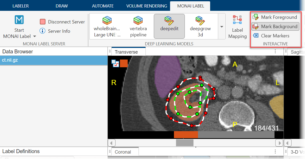 Medical Image Labeler window, showing drawn foreground and background markers for the right kidney.