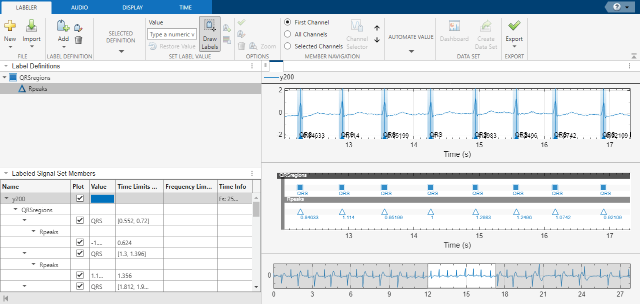 Automate Signal Labeling with Custom Functions