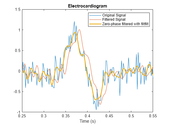 Figure contains an axes object. The axes object with title Electrocardiogram, xlabel Time (s) contains 3 objects of type line. These objects represent Original Signal, Filtered Signal, Zero-phase filtered with filtfilt.