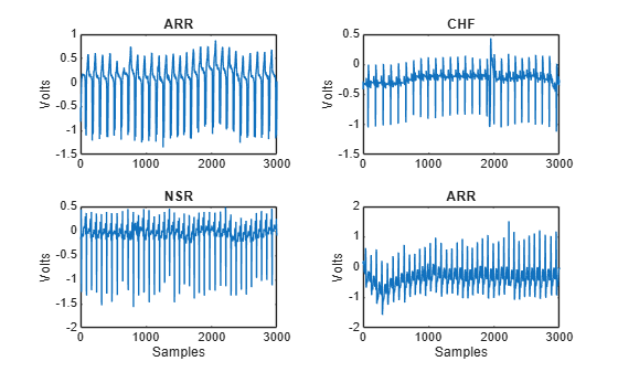 Figure contains 4 axes objects. Axes object 1 with title ARR, ylabel Volts contains an object of type line. Axes object 2 with title CHF, ylabel Volts contains an object of type line. Axes object 3 with title NSR, xlabel Samples, ylabel Volts contains an object of type line. Axes object 4 with title ARR, xlabel Samples, ylabel Volts contains an object of type line.