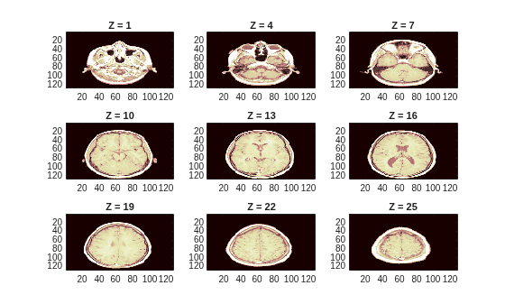 Figure contains 9 axes objects. Axes object 1 with title Z = 1 contains an object of type image. Axes object 2 with title Z = 4 contains an object of type image. Axes object 3 with title Z = 7 contains an object of type image. Axes object 4 with title Z = 10 contains an object of type image. Axes object 5 with title Z = 13 contains an object of type image. Axes object 6 with title Z = 16 contains an object of type image. Axes object 7 with title Z = 19 contains an object of type image. Axes object 8 with title Z = 22 contains an object of type image. Axes object 9 with title Z = 25 contains an object of type image.