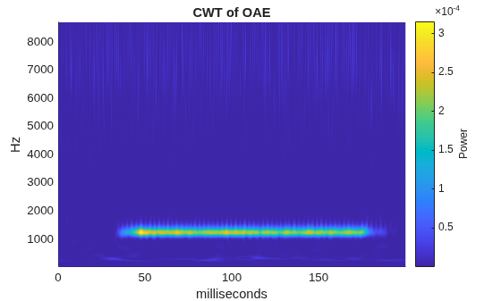 Figure contains an axes object. The axes object with title CWT of OAE, xlabel milliseconds, ylabel Hz contains an object of type surface.