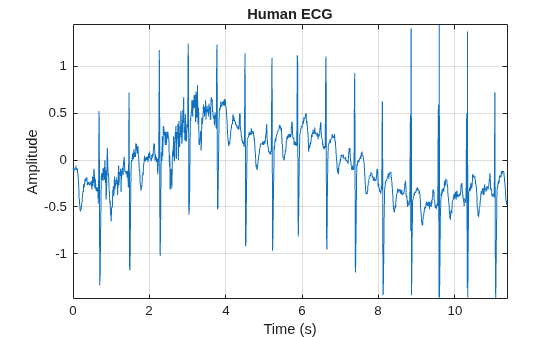 Figure contains an axes object. The axes object with title Human ECG, xlabel Time (s), ylabel Amplitude contains an object of type line.