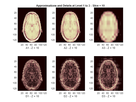 Figure contains 6 axes objects. Axes object 1 with xlabel A1 - Z = 10 contains an object of type image. Axes object 2 with xlabel D1 - Z = 10 contains an object of type image. Axes object 3 with title Approximations and Details at Level 1 to 3 - Slice = 10, xlabel A2 - Z = 10 contains an object of type image. Axes object 4 with xlabel D2 - Z = 10 contains an object of type image. Axes object 5 with xlabel A3 - Z = 10 contains an object of type image. Axes object 6 with xlabel D3 - Z = 10 contains an object of type image.