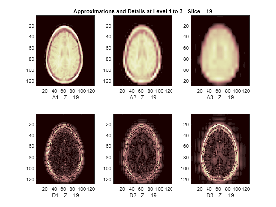 Figure contains 6 axes objects. Axes object 1 with xlabel A1 - Z = 19 contains an object of type image. Axes object 2 with xlabel D1 - Z = 19 contains an object of type image. Axes object 3 with title Approximations and Details at Level 1 to 3 - Slice = 19, xlabel A2 - Z = 19 contains an object of type image. Axes object 4 with xlabel D2 - Z = 19 contains an object of type image. Axes object 5 with xlabel A3 - Z = 19 contains an object of type image. Axes object 6 with xlabel D3 - Z = 19 contains an object of type image.