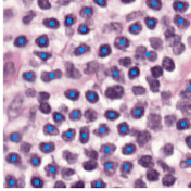 Blue point markers overlaid on a histology image of stained cells