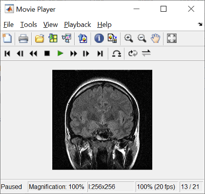 Video Viewer app displaying one frame of a grayscale image sequence, information about the video, and playback controls.