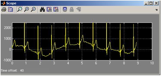 highspeed